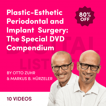 Plastic-Esthetic Periodontal and Implant Surgery: The Special DVD Compendium