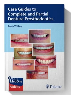 Case Guides to Complete and Partial Denture Prosthodontics